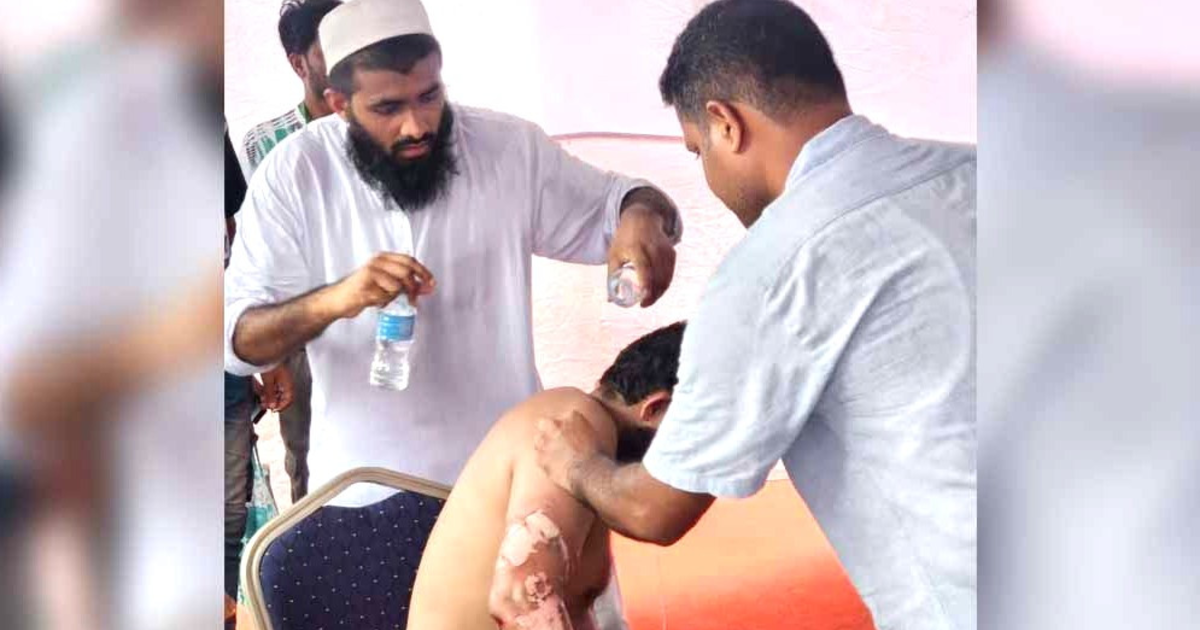 মানিক মিয়া এভিনিউতে গ্যাস বেলুন বিস্ফোরণ - আহত ১০