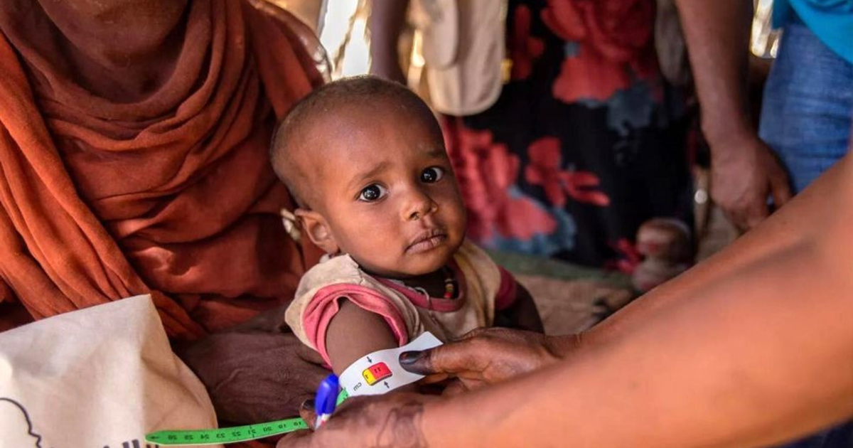 যুদ্ধবিধ্বস্ত সুদানে অপুষ্টিতে এক মাসে ২৩ শিশুর করুণ মৃত্যু